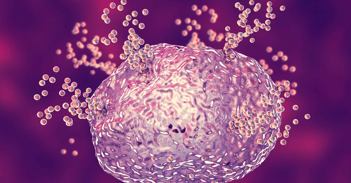 Histamine Intolerance